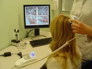 Diagnostic du psoriasis sur le cuir chevelu